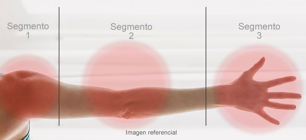 Tratamiento por segmento